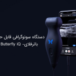 دستگاه سونوگرافی